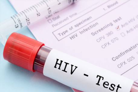 Khám, tư vấn, điều trị phơi nhiễm HIV