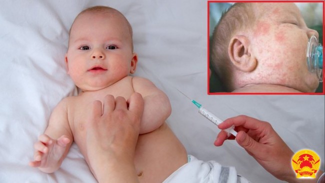 Mọi người dân kể cả người lớn tuổi chưa tiêm vắc xin phòng bệnh sởi cần đến ngay cơ sở y tế để tiêm phòng