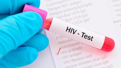 Dịch COVID-19 gây cản trở tiếp cận dịch vụ phòng chống HIV/AIDS, gia tăng số người nhiễm