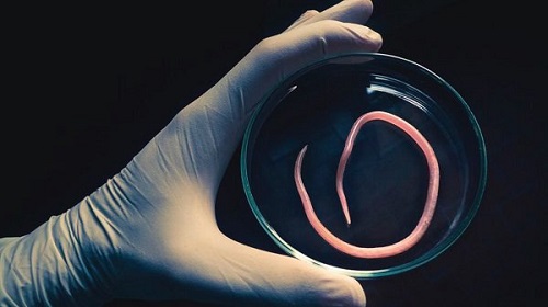 Xét nghiệm ký sinh trùng: Những điều cần biết