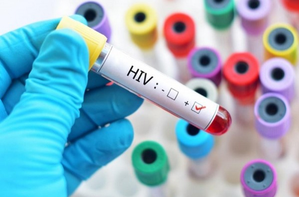 7 yếu tố làm tăng nguy cơ nhiễm HIV