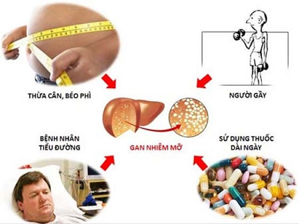Một số thuốc có thể gây gan nhiễm mỡ...