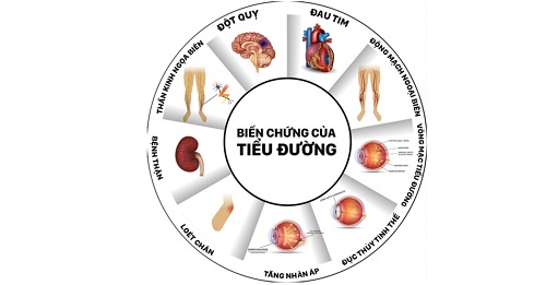 Khuyến cáo mới trong điều trị đái tháo đường