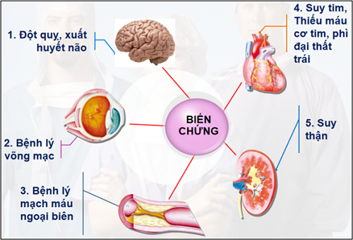 Thời tiết lạnh, người bệnh tăng huyết áp hạn chế những thực phẩm này để phòng ngừa biến chứng