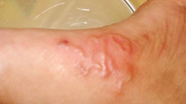 Ôm ấp, vuốt ve chó mèo có thể mắc căn bệnh gây tổn thương não