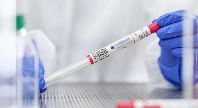 Đề xuất BHYT chi trả sàng lọc ung thư cổ tử cung, vú, tăng huyết áp, đái tháo đường, viêm gan B, C