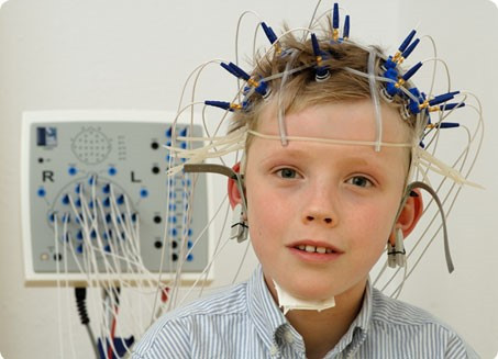 Tìm hiểu bệnh động kinh ở trẻ?