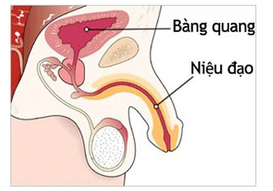 Bệnh nhân hẹp niệu đạo nên có chế độ ăn như thế nào?