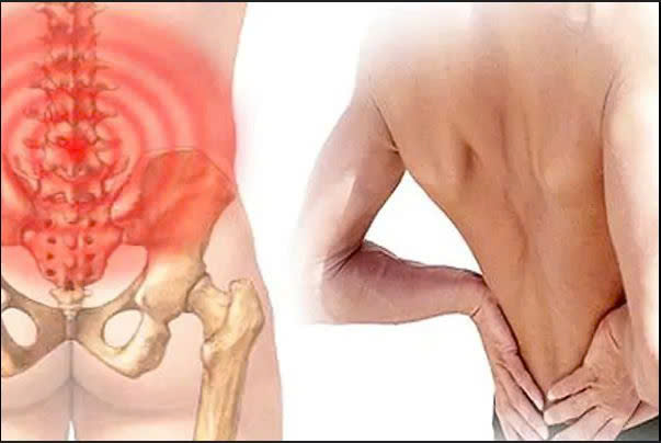 Chèn ép dây thần kinh thẹn: Nguyên nhân, biểu hiện, cách điều trị và phòng bệnh