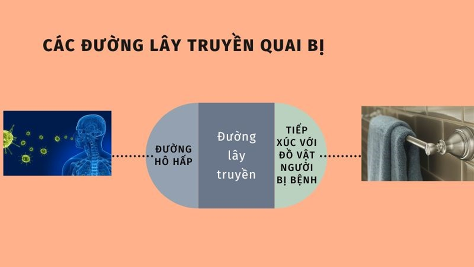 PHÒNG CHỐNG BỆNH QUAI BỊ