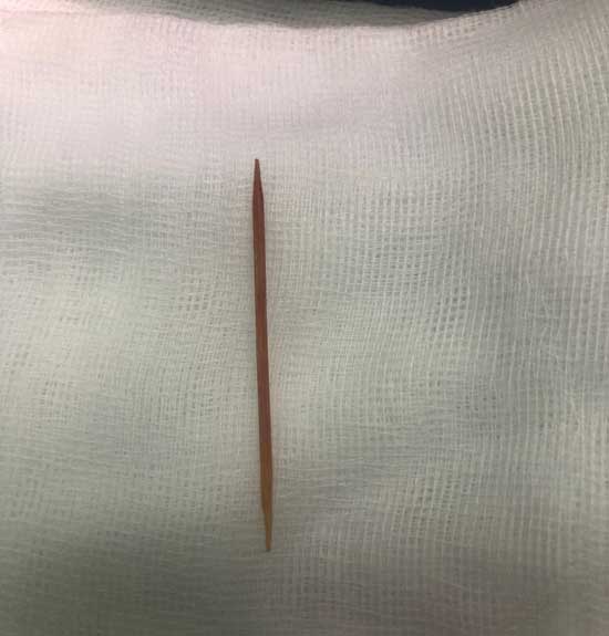 2302212
