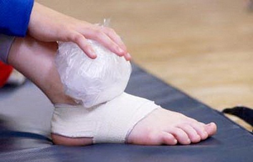 Chườm đá tại vị trí sưng nề mỗi ngày 3-4 lần để điều trị bong gân.